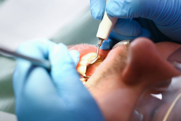Best Emergency Broken Tooth Repair in Jeannette, PA